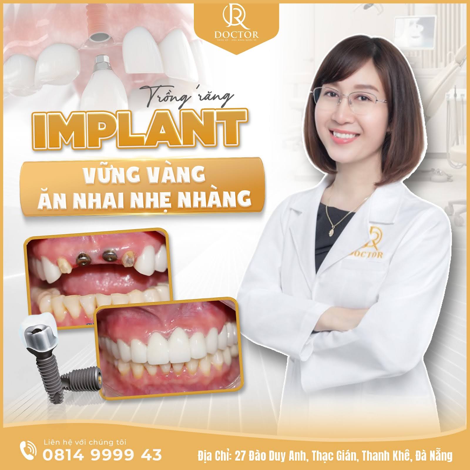 Bác sĩ trồng răng Implant tại Đà Nẵng - Nha khoa Doctor