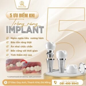 Cập nhật chi tiết trồng răng implant giá bao nhiêu tại Đà Nẵng.