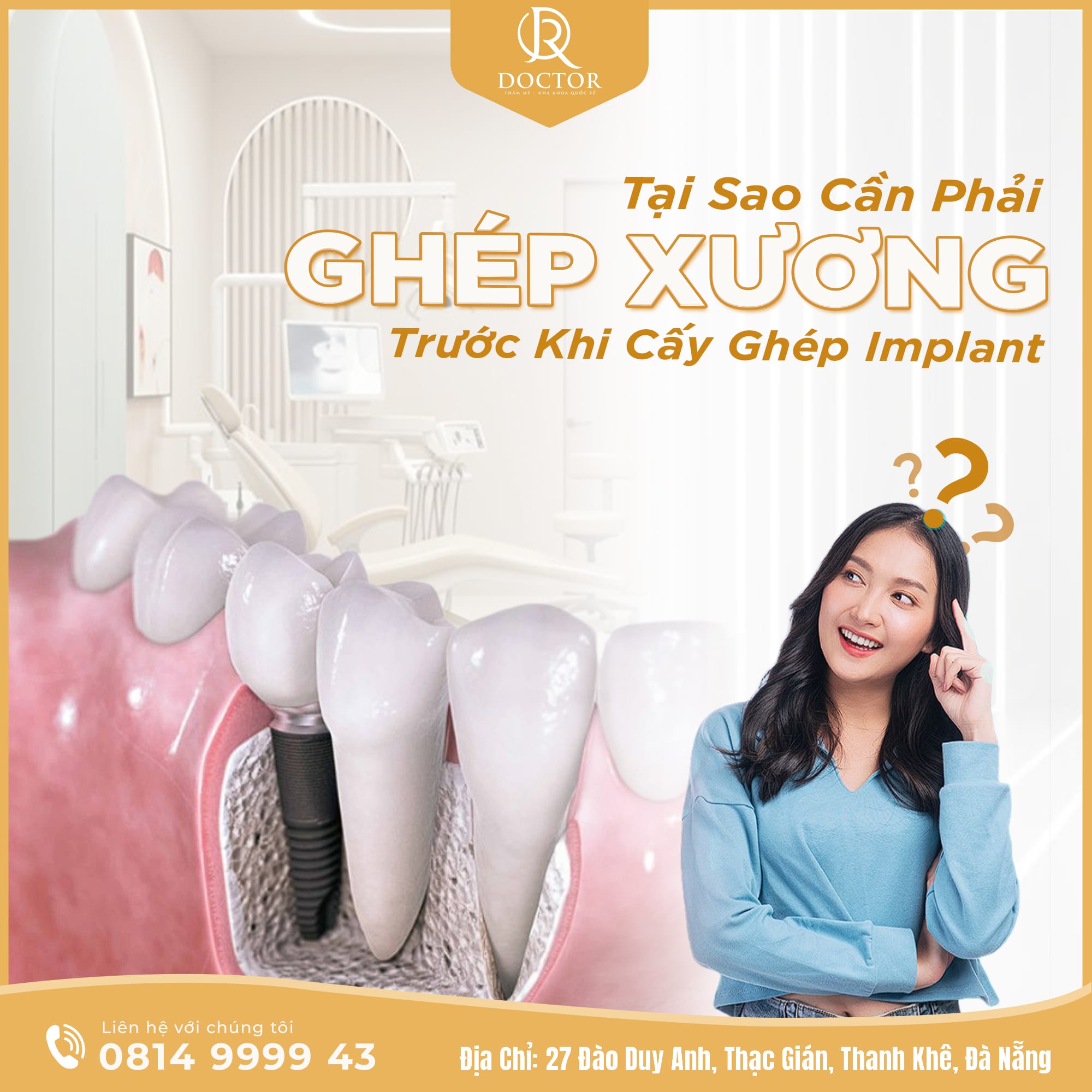 Bảng giá trồng răng Implant Đà Nẵng 2026 Bảng giá trồng răng Implant Đà Nẵng 2026