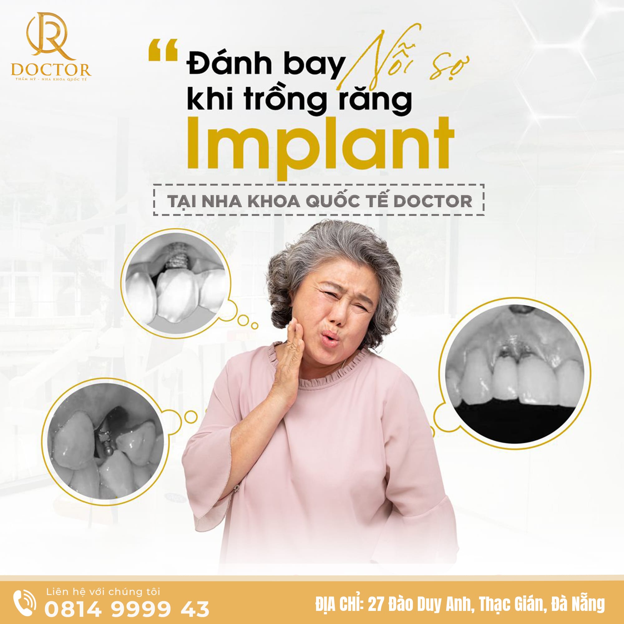 Trồng răng Implant Đà Nẵng giá tốt 2026 Trồng răng Implant Đà Nẵng giá tốt 2026